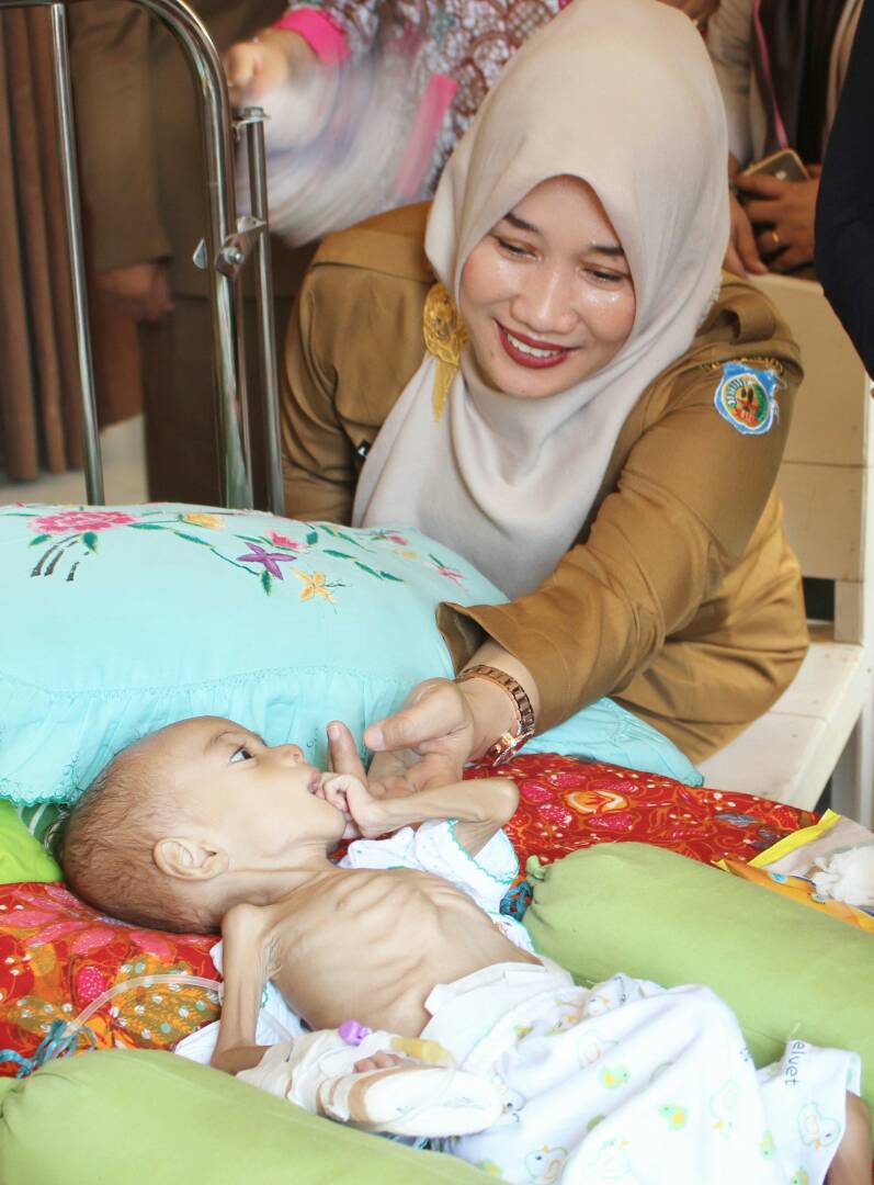 Rayakan Ulang Tahun Ke 41, Istri Bupati Kepulauan Selayar Kunjungi Bayi Penderita Gizi Buruk