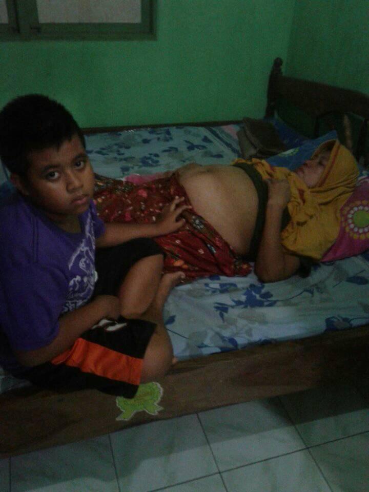 Janda Penderita Kista Ganas ini Butuh Uluran Tangan Untuk Berobat